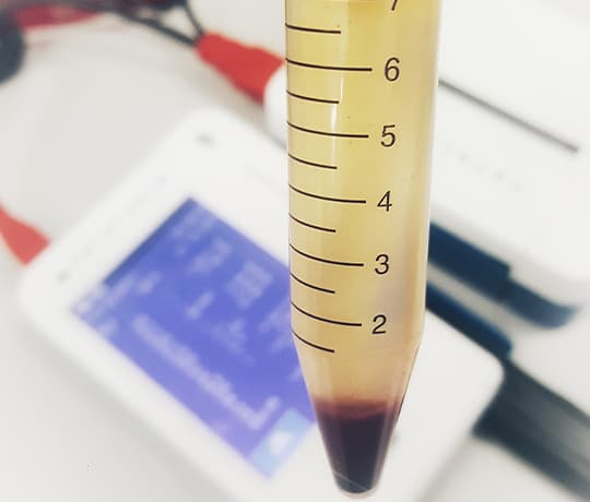 Ein Röhrchen mit Urin und Blut wird im Labor untersucht
