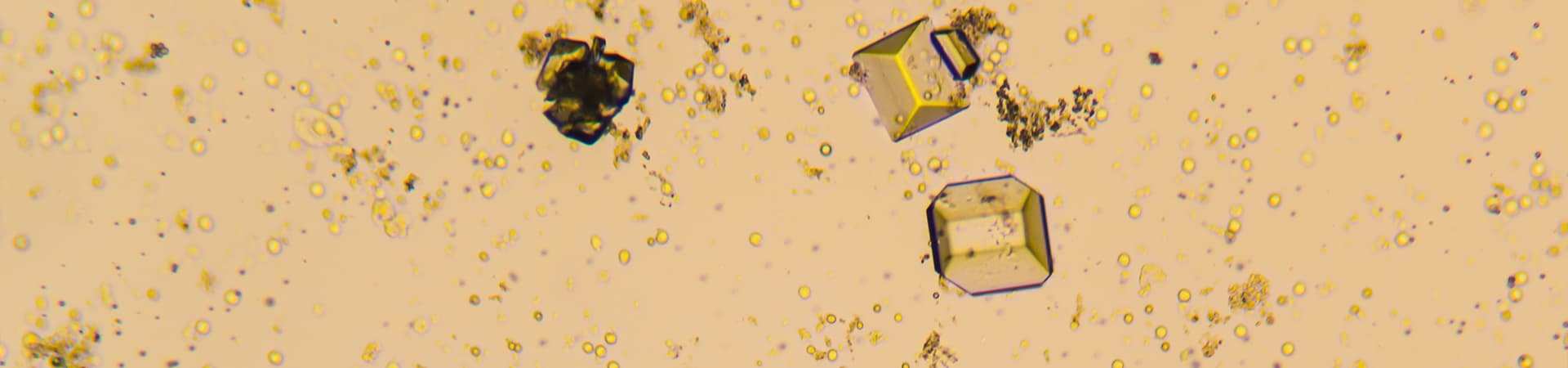 Struvitkristalle unter dem Mikroskop